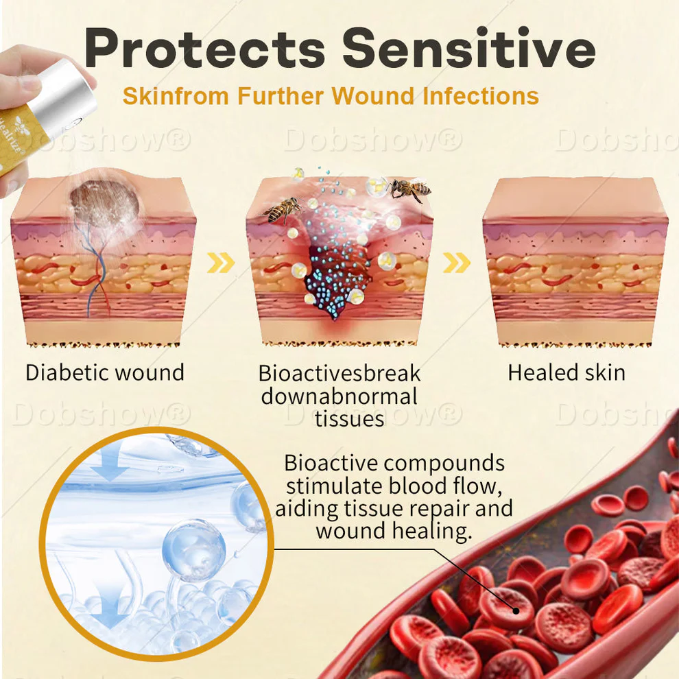 Healrize® GlucoShield Bee Venom Wound Spray image Healrize® GlucoShield Bee Venom Wound Spray