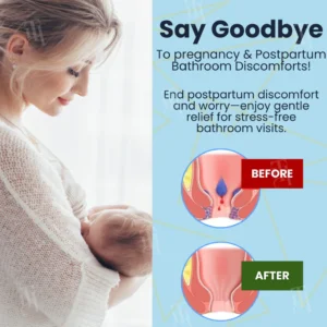 Cvreoz® Herbal Hemorrhoid Treatment Anal Spray