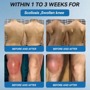 GFOUK BPC-157 Joint Healing Capsules