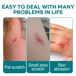 Croaie® SKINSHIELD QUICKDRYING LIQUID BANDAGE