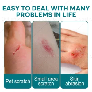 Croaie® SkinShield QuickDrying Liquid Bandage image Croaie® SkinShield QuickDrying Liquid Bandage