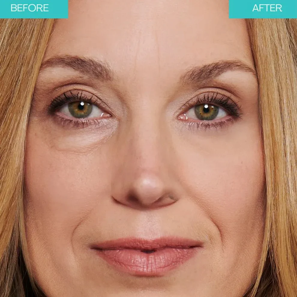 Bright Up - Smooths out wrinkles instantly