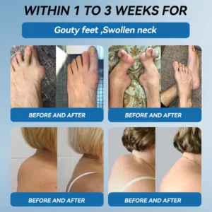 Croaie® B.P.C-157 Joint Healing Cream image Croaie® B.P.C-157 Joint Healing Cream