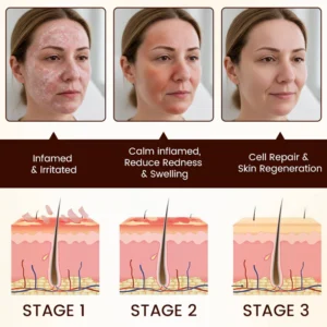 Cvreoz® Bee Venom Multi-Repair Cream image Cvreoz® Bee Venom Multi-Repair Cream