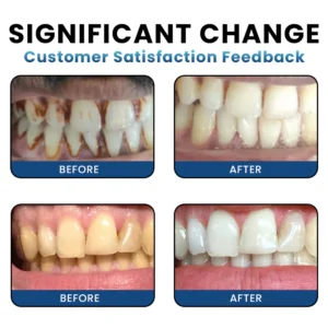 LIMETOW® Teeth Whitening Essence