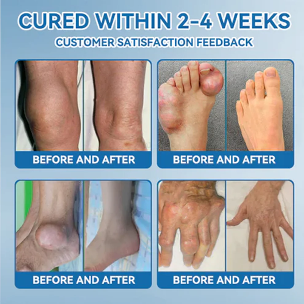 QIAWI BPC-157 Joint Healing Cream image QIAWI BPC-157 Joint Healing Cream