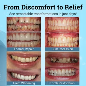 AEXZR® Non-Surgical Gum "Suture" Gel image AEXZR® Non-Surgical Gum