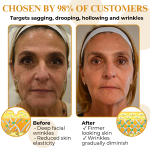 AEXZR® Letybo Bee Venom Wrinkle Removal Cream