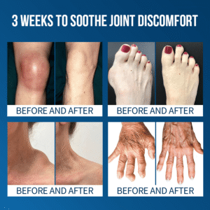 Lyyeto® Flexfixer Joint Relief Serum Ampoule