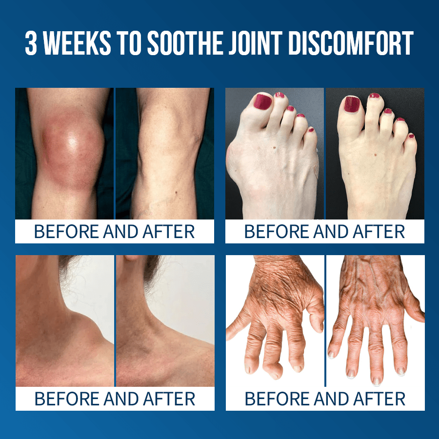 Lyyeto® Flexfixer Joint Relief Serum Ampoule