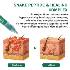 Cvreoz®Snake Peptide Shingles Skincare Ampoules