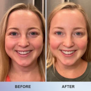 LIMETOW™ Line Smoothing Eye Cream image LIMETOW™ Line Smoothing Eye Cream