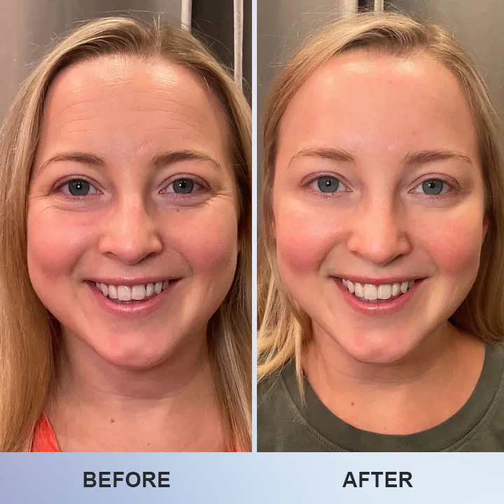 LIMETOW™ Line Smoothing Eye Cream image LIMETOW™ Line Smoothing Eye Cream