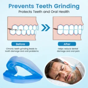 JEREMYTIS Anti-snoring Mouthpiece