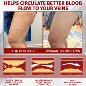 NovaRX® Red Vine FluidRelief Edema Gel image NovaRX® Red Vine FluidRelief Edema Gel