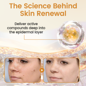 Timilk® BeeVenom Wart Renewal Spray