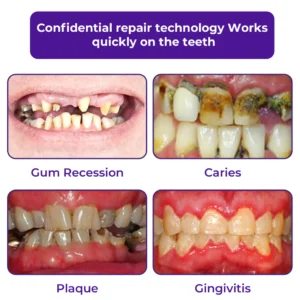 Dobshow® Dental Repair Mineral Powder