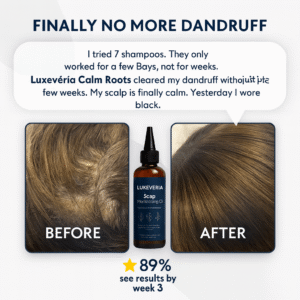 luxevéria Skalp Moisturuzing Oil When Water Feels Like Acid and Your Skin Is on Fire image luxevéria Skalp Moisturuzing Oil