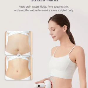 Slimoly Lymphatic Drainage & Cellulite-Combating Massager image Slimoly Lymphatic Drainage & Cellulite-Combating Massager