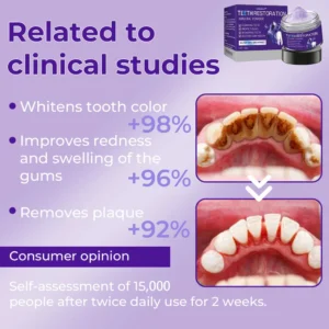 Dobshow® Dental Repair Mineral Powder