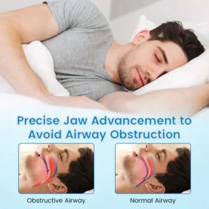 JEREMYTIS Anti-snoring Mouthpiece