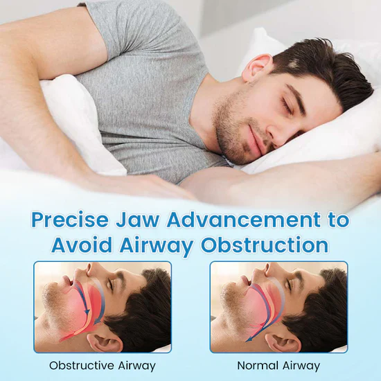 JEREMYTIS Anti-snoring Mouthpiece