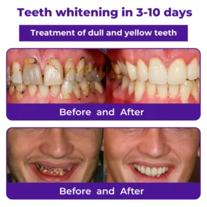 Dobshow® Dental Repair Mineral Powder