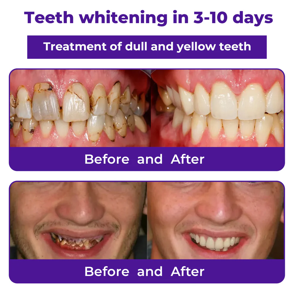 Dobshow® Dental Repair Mineral Powder