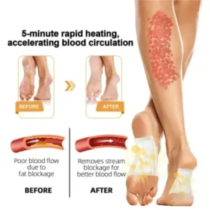 Loyesta Bee Venom Ginger & Honey Detox Pads image Loyesta Bee Venom Ginger & Honey Detox Pads