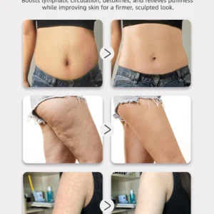 Slimoly Lymphatic Drainage & Cellulite-Combating Massager image Slimoly Lymphatic Drainage & Cellulite-Combating Massager