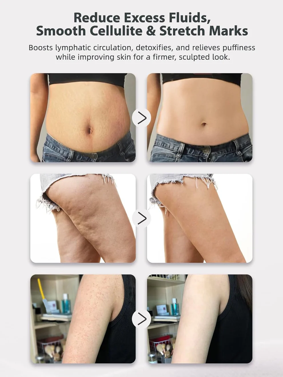 Slimoly Lymphatic Drainage & Cellulite-Combating Massager image Slimoly Lymphatic Drainage & Cellulite-Combating Massager