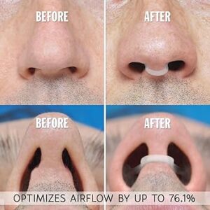 ZALUNAS Serene (Nasal): All 3 colours included