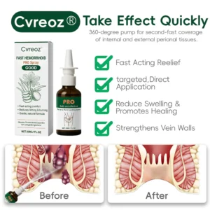 Cvreoz® Fast Hemorrhoid PRO Spray
