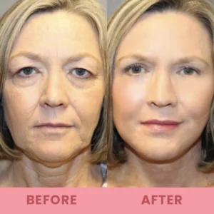 LIMETOW™ Compact Anti-wrinkle Bar image LIMETOW™ Compact Anti-wrinkle Bar