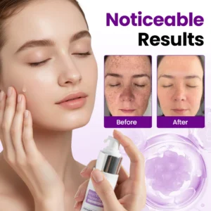 Tiworld® SpotErase Probiotic Shield Serum image Tiworld® SpotErase Probiotic Shield Serum