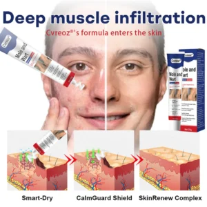 Cvreoz® Mole and Wart Removal Cream image Cvreoz® Mole and Wart Removal Cream
