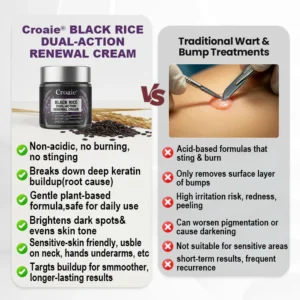Croaie® KeraErase RICEDUAL-ACTION RENEWAL CREAM
