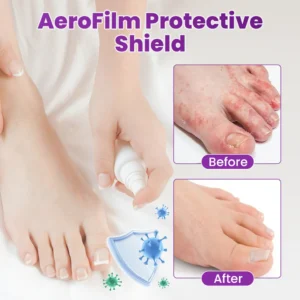 Cvreoz® AeroFilm Foot Defense Mist image Cvreoz® AeroFilm Foot Defense Mist