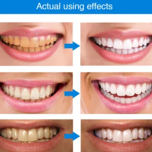 LIMETOW® Teeth Whitening Essence