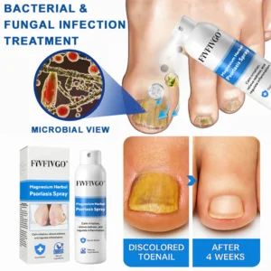 Fivfivgo® Magnesium Herbal Psoriasis Spray image Fivfivgo® Magnesium Herbal Psoriasis Spray