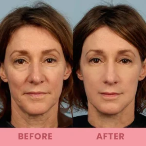 LIMETOW™ Compact Anti-wrinkle Bar image LIMETOW™ Compact Anti-wrinkle Bar