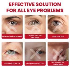 LIMETOW® Retinol Eye Stick