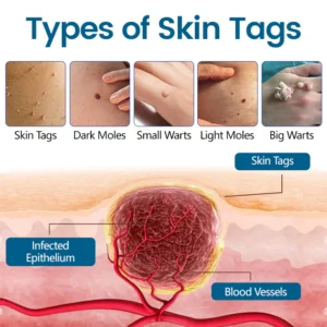 Timilk® DermaVenom RX+ Precision Removal Cream image Timilk® DermaVenom RX+ Precision Removal Cream