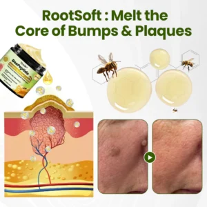 Timilk® BeePeptide RootSoft DualRelief Cream