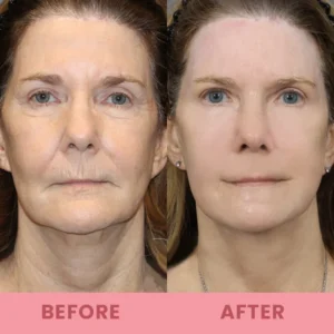 LIMETOW™ Compact Anti-wrinkle Bar image LIMETOW™ Compact Anti-wrinkle Bar