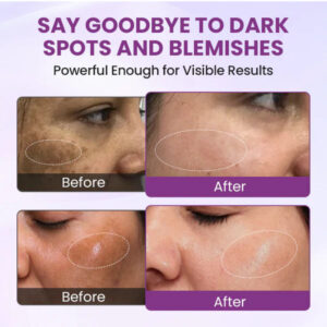 Biancat® RadiantClear Blemish & Brightening Serum