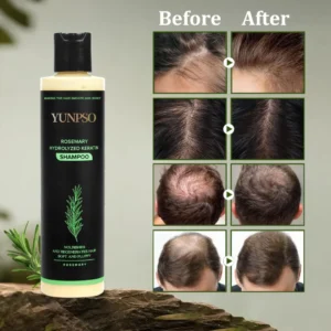 YUNPSO Organic Rosemary Hair Growth Shampoo & Hair Conditioner image YUNPSO Organic Rosemary Hair Growth Shampoo & Hair Conditioner