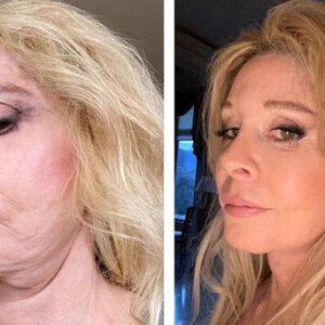 LEFUN® Skin Rejuvenation and Tightening Oil