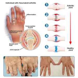 Taileden® BPC-157 Joint Healing Cream image Taileden® BPC-157 Joint Healing Cream
