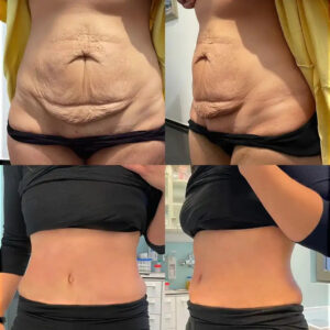 LEFUN® Skin Rejuvenation and Tightening Oil